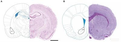 The long-term effects of maternal deprivation on the number and size of inhibitory interneurons in the rat amygdala and nucleus accumbens